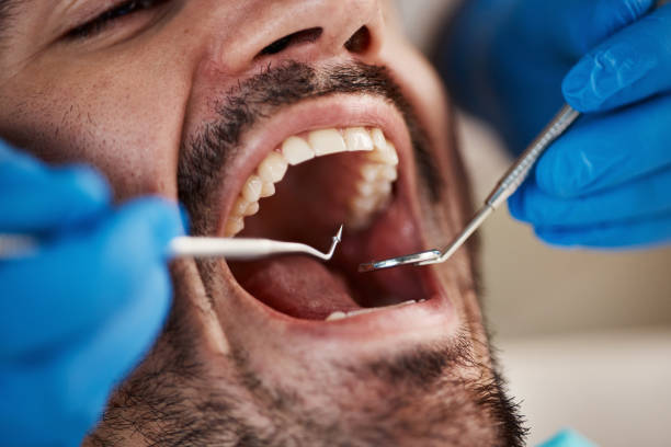 Best Emergency TMJ Treatment in Diamondhead, MS